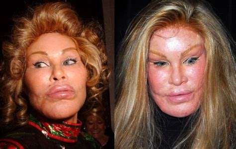 Jocelyn Wildenstein Before And After Plastic Surgery 02 Celebrity