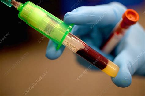 Blood Collection Stock Image C0429934 Science Photo Library