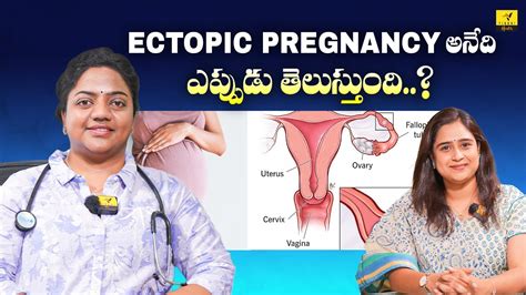 Lifetime Of Ectopic Pregnancy: Duration Of Abnormal Pregnancy