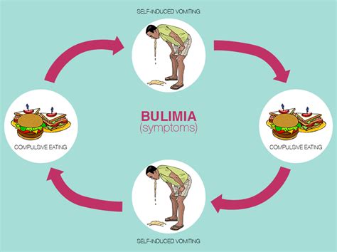 Bulimia Causes Symptoms And Treatment Healthtopia