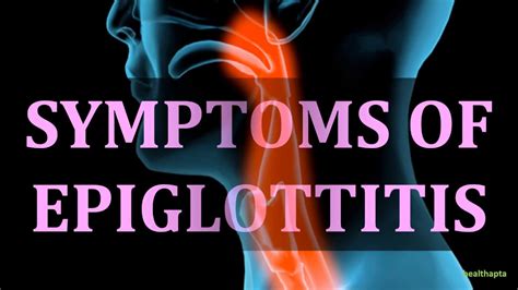 Symptoms Of Epiglottitis Youtube