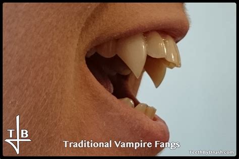 Traditional Vampire Teeth By Dnash