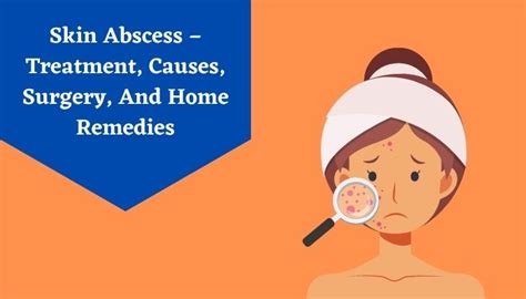 Skin Abscess Treatment At Home Skin Abscess Treatment Its Causes