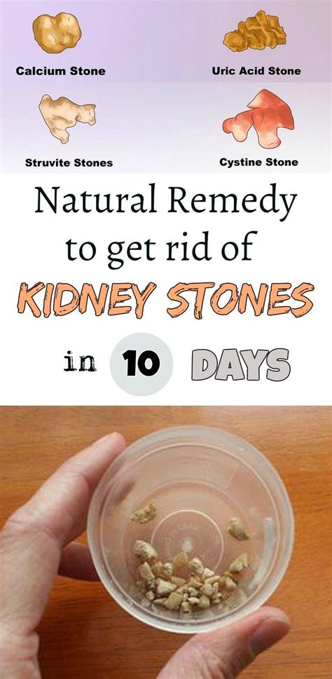 Natural Remedy To Get Rid Of Kidney Stones In 10 Days Natural