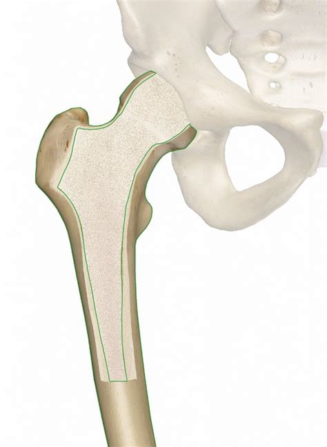 Cortical Compact Bone