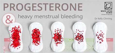 Progesterone Therapy For Heavy Menstrual Bleeding White Lotus Clinic
