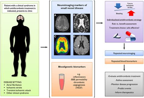 Frontiers Cerebral Microbleeds On Magnetic Resonance Imaging And
