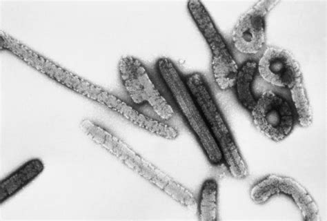 Ebola virus and marburg virus live in animal hosts. Marburg-Virus - Wikipedia