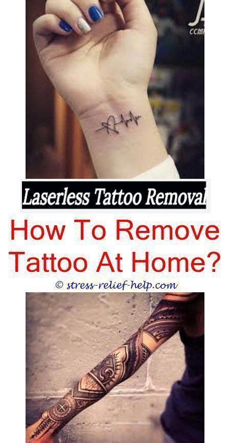 Pin Auf Tattoo Removal