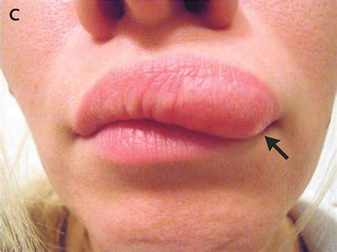 Nose Bump Porn - skin close up face nose lip zdjÄ™cie porno | My XXX Hot Girl