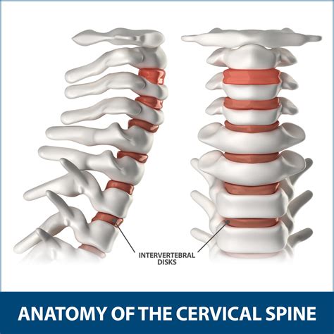 Pinched Nerve In The Neck Florida Orthopaedic Institute