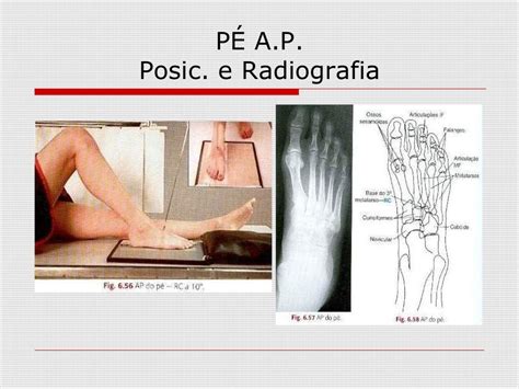 Posicionamento Radiologico