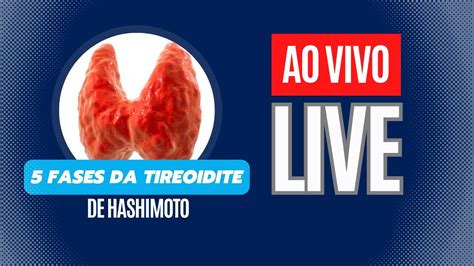 Os estágios da TIREOIDITE DE HASHIMOTO Dr Rogério Leite YouTube