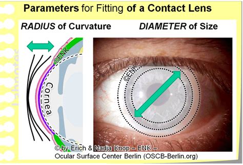 Deeper Insight Into Contact Lenses History Types