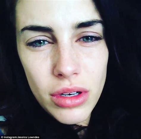 Jessica Lowndes Before Plastic Surgery