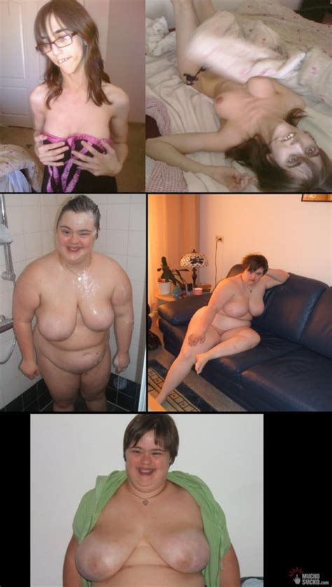 Syndrome Porno Down Nude Quality Sex Photo