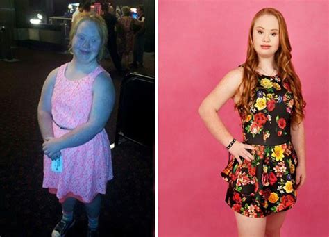 Madeline Is An Inspiring Young Woman With Down Syndrome Who Wants To Be A Model Art Sheep