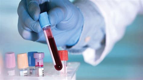 nuevo test de sangre podría detectar hasta 50 tipos de cáncer actualidad