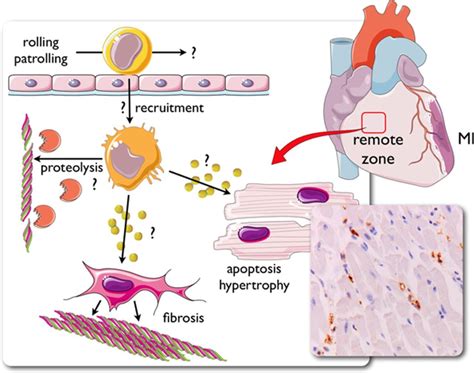 Monocyte And Macrophage Heterogeneity In The Heart Circulation Research