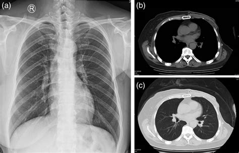 Digital Radiography D And Computed Tomographic Ct Examination Of Download Scientific