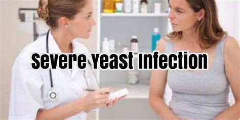 Severe Yeast Infection Yeastinfection Yeast Infection Severe