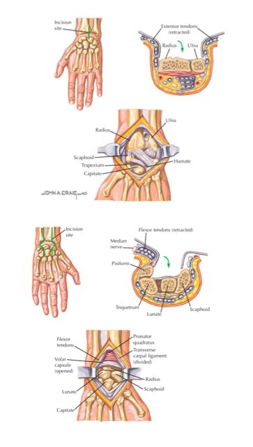 Dorsal And Volar Approaches To Wrist Joint Diagram Quizlet