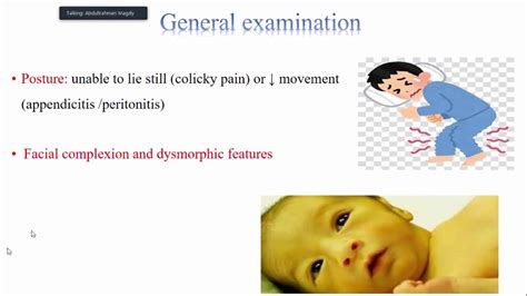 Pediatrics Abdominal Examination 2642020 Youtube