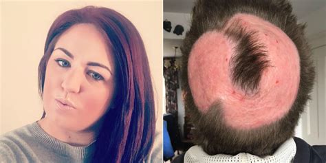This Mom Tried To Pastel Dye Her Hair At Home But Ended Up Bald