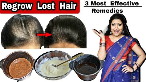 100 Regrow Lost Hair Naturally 3 Most Powerful Ways To Grow Lost