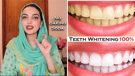 Teeth Whitening At Home 100 Easy Effective Tips For Sensitivity And Gums