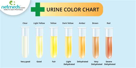 Different Colours Of Urine Know What They Imply About Overall Health