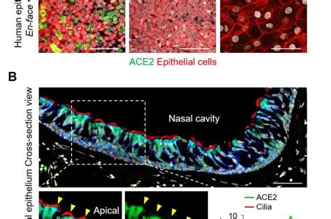 Sars Cov 2 Replication Targets Nasal Ciliated Cells Early In Covid 19