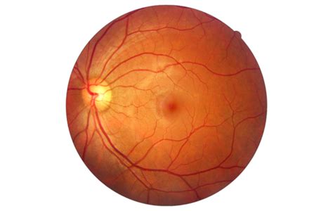 Retina Fundus Photo