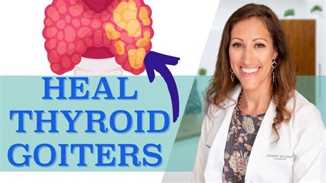 How To Shrink Thyroid Nodules Thyroid Cysts And Thyroid Goiters