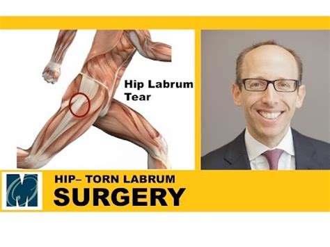 Hip Pain - Torn Labrum Hip - YouTube