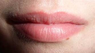 White Bumps Under Skin On Lips