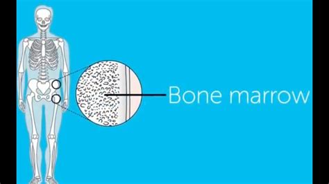 Bone Marrow Test Youtube
