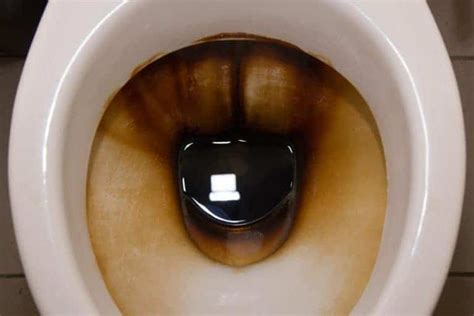 How To Clean A Very Stubborn Stained Toilet Bowl Causes And Prevention