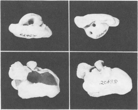 Tympanic Bullae And Periotics Of Phocoena Sinus Sdnhm 20688 Dorsal