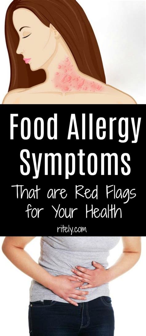 Food Allergy Symptoms That Are Red Flags For Your Health Allergy