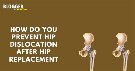 Which Is Not A Guideline For Avoiding Hip Dislocation After Replacement