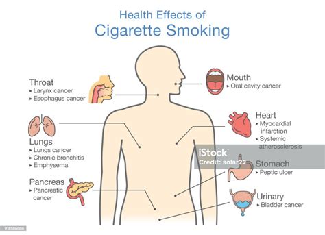 Diagram About Health Effect Of Cigarette Smoking Stock Illustration