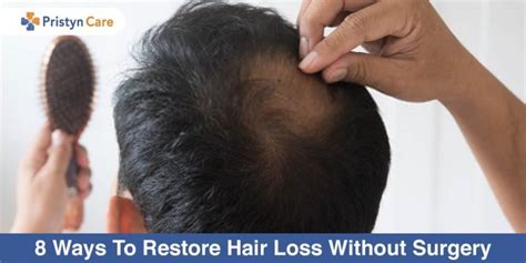 8 Ways To Restore Hair Loss Without Surgery Pristyn Care