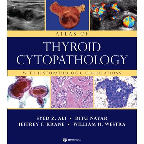 Atlas Of Thyroid Cytopathology