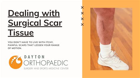 Dealing With Surgical Scar Tissue Dayton Orthopaedic Surgery