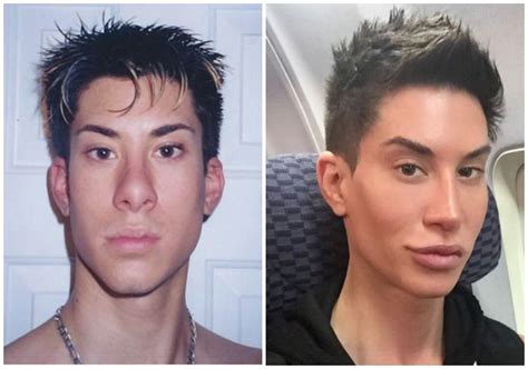 See What Human Ken Doll Justin Jedlica Looked Like Before Plastic Surgery