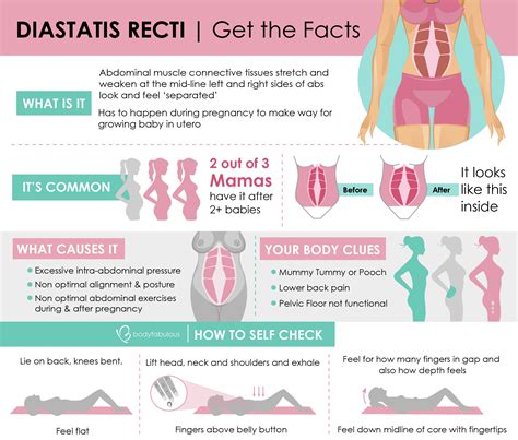 How To Measure Your Diastatis Recti Abdominal Separation