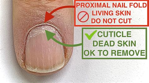 How To Fix Cuticles You Ve Been Cutting The Wrong Thing Youtube