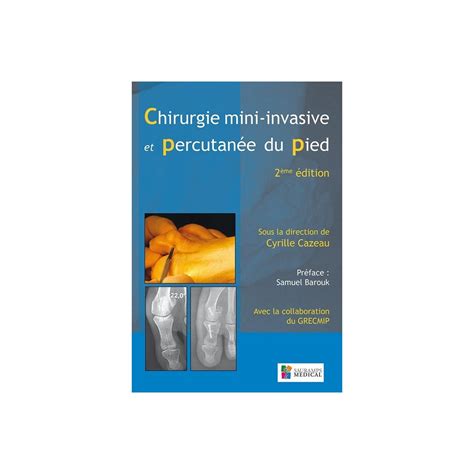 Chirurgie Mini Invasive Et Percutan E Du Pied Vg Librairie