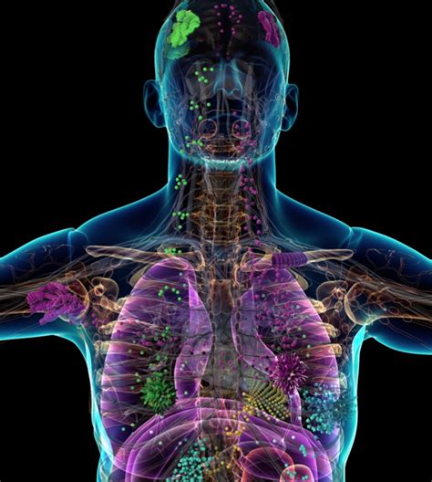 Or, the cause of a symptom may be a different medical condition that is not. In-Depth Analysis of Metastatic Cancer Could Enable More ...